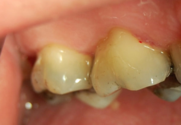 dentalni hygiena